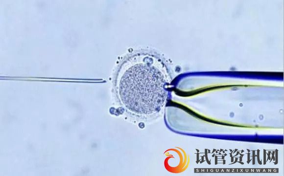 成都卵巢反应与试管婴儿成功率的关系(图2)
