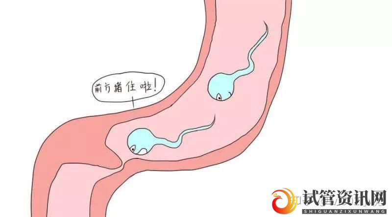成都输卵管堵塞想做试管婴儿,拿到结果后我哭了,输卵管(图4)