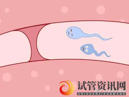 成都输卵管不孕做试管婴儿手术过程中,常见的六个问题及(图1)
