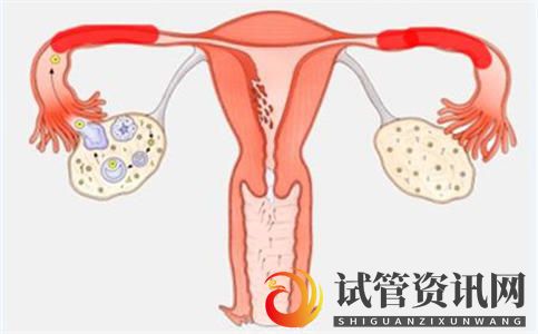 成都输卵管通而不畅？还可能怀孕吗？(图2)