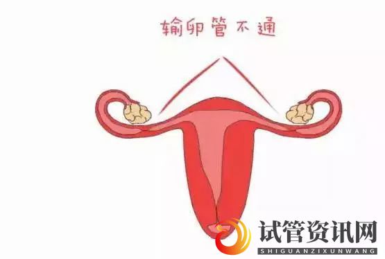 成都曾被诊断输卵管通而不畅,1个月逆转成功怀孕(图3)