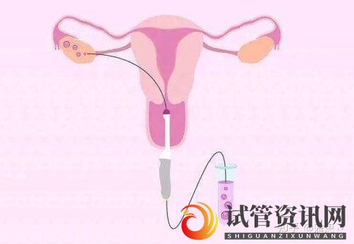 成都输卵管不畅做试管婴儿助孕一定会成功吗(图3)