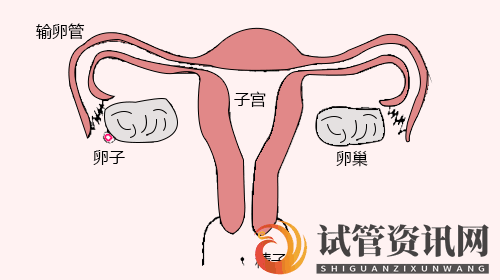 成都做了结扎手术还能怀孕吗？输卵管复通术成功率与什么相关？(图1)