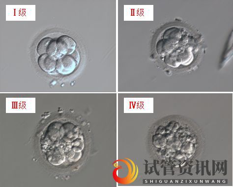 试管资讯网:胚胎能看出来男女吗(图1)
