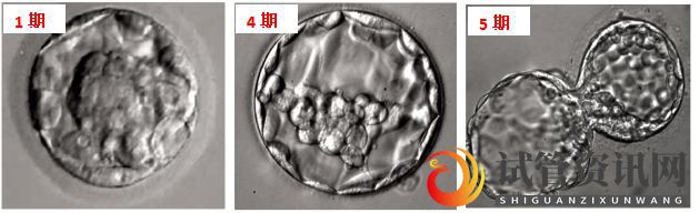 试管资讯网:胚胎能看出来男女吗(图3)