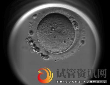 试管资讯网:胚胎移植后,多久才能够知道是否着床受孕(图4)