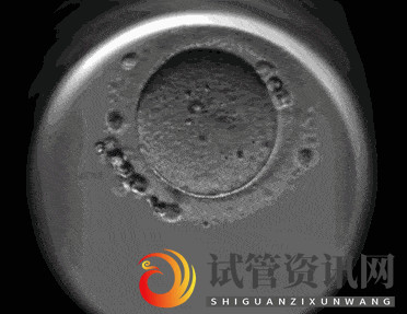 揭阳试管婴儿医院引进“时差培养箱”，助力筛选更具发育潜力的胚胎(图2)