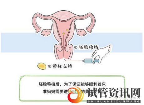 女人做试管过程痛苦吗(多囊卵巢能怀上孩子吗)(图5)