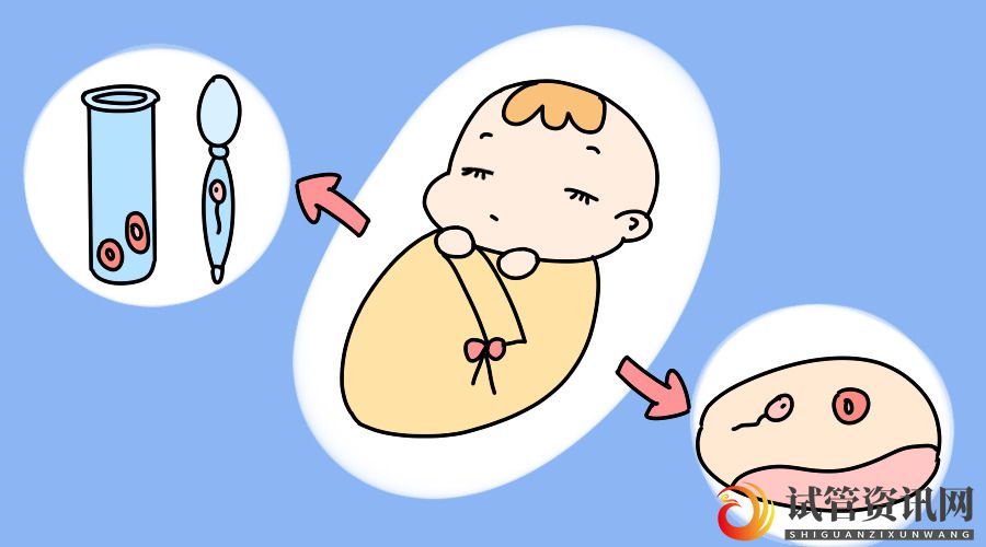 做试管婴儿会痛吗？需要打麻醉吗？(多囊卵巢能怀上孩子吗)(图2)