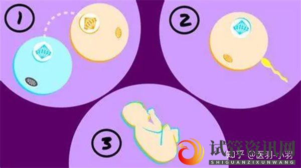 试管婴儿移植应避免多胎妊娠减胎存在哪些第四代试管婴儿技术可以打破生育年龄的限制(图3)